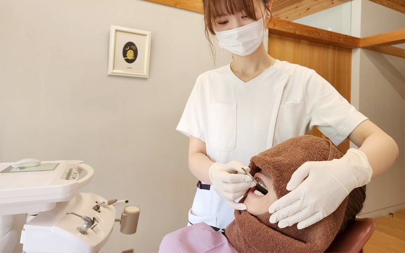 ホームホワイトニング用のマウスピースの型取り